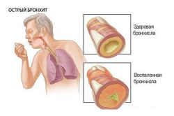 Complicații ale tratamentului și consecințelor bronșitei