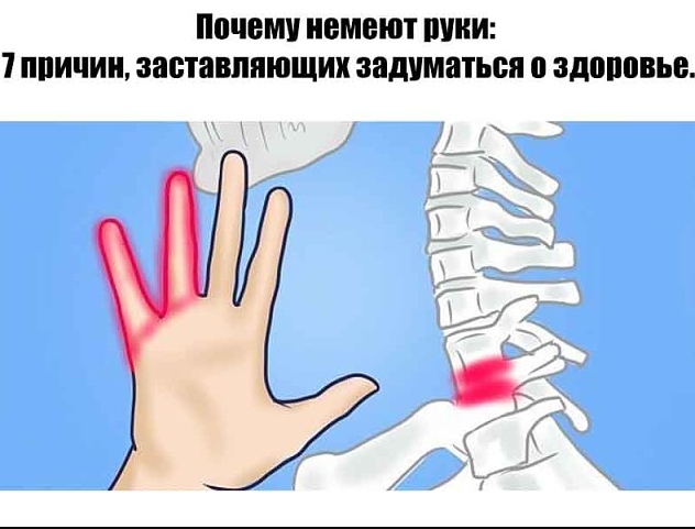 Чому німіють руки 7 причин, які змушують задуматися про здоров'я