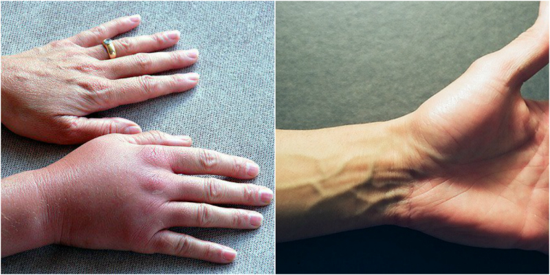Причини оніміння рук
