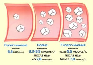 Проведення лікування гіпоглікемії народними засобами