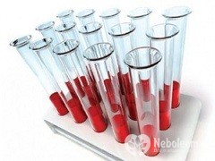 Compatibilitatea grupurilor de sânge