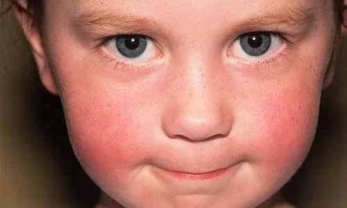 Стодаль від кашлю для дітей ефективне гомеопатичний засіб