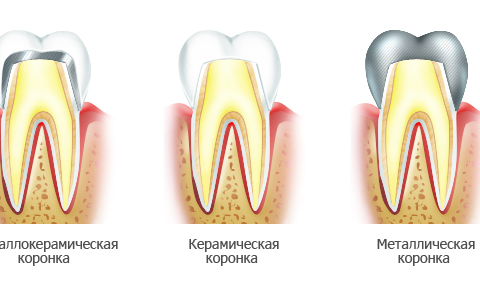 Stomatologie - fetichita, cea mai bună stomatologie din Chelyabinsk