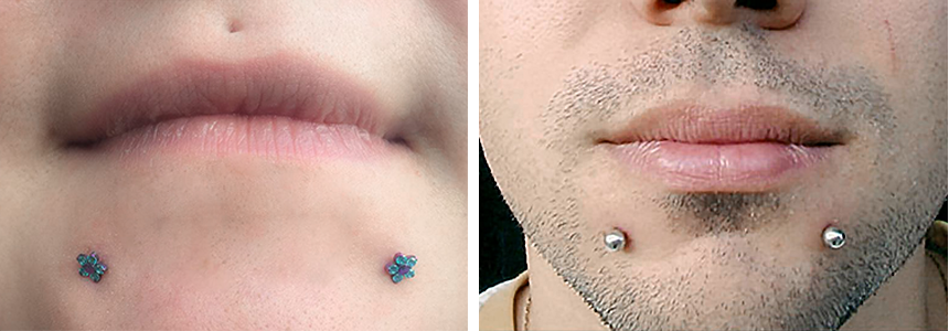 Studio piercing - piercing nedorit