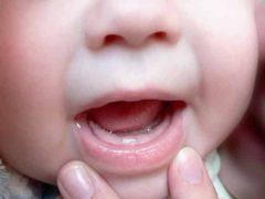 Temperatura la erupția dinților la copii este cât de mult păstrează, motivele care trebuie făcute