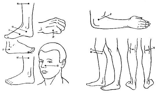 Acupressure cu alergii