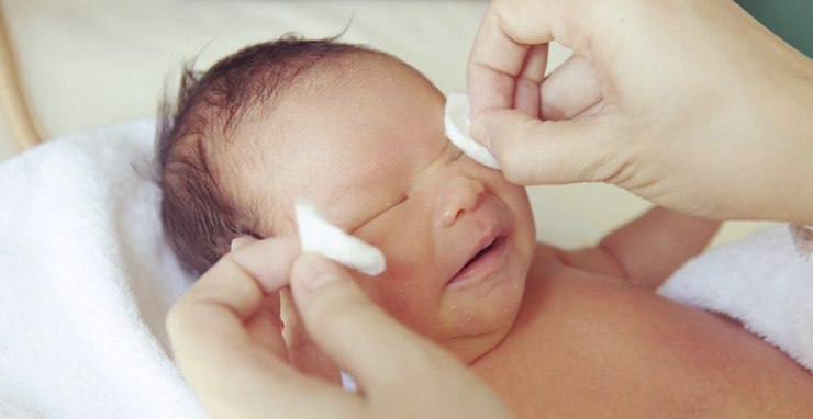 Îngrijirea ochilor pentru un nou-născut Copil