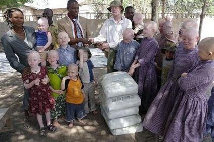 Az, hogy az albínók Tanzánia darabokra vágjuk, blog tolmács