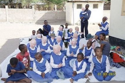 За що альбіносів в Танзанії рубають на шматки, блог тлумача