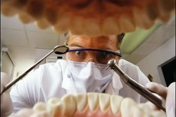 Зубний камінь причини і лікування
