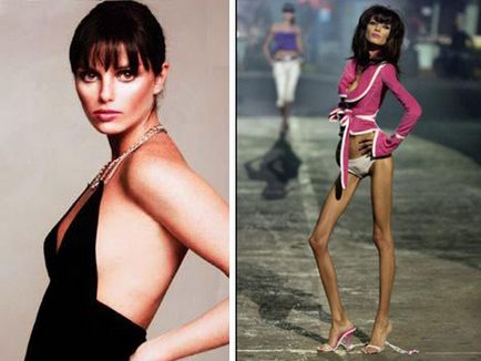 Fetele anorexice sunt elegante sau dezgustatoare