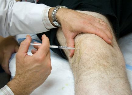 Артрит колінного суглоба симптоми і лікування, причини захворювання