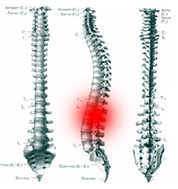 Ayurveda pentru spate - boli comune ale coloanei vertebrale și spate