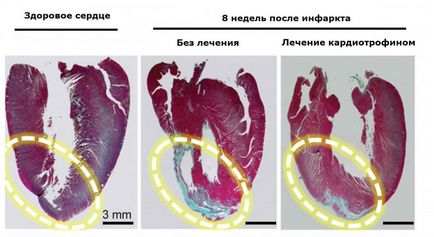 Protein podlechites szív, arra kényszerítve őt - azt gondolni, hogy egy képzett személy