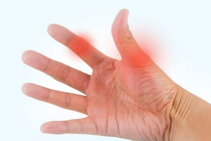 Bursita încheieturii mâinii încheietura mâinii, tratamentul articulației