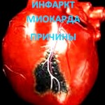 Patru cauze ale infarctului miocardic, aflați despre ele