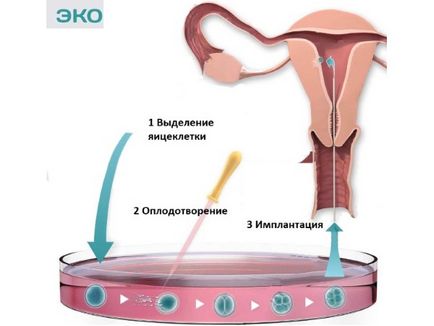 Mi késő embrióbeültetésben (Kérjük, hogy kezelőorvosa) Mi késő embrióbeültetésben