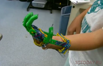 Дешеві протези, роздруковані на 3d-принтерах - майбутнє медицини