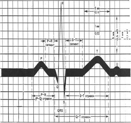 Elemente ale ecg