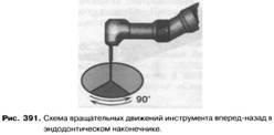 Ендодонтичні наконечники і машинні інструменти для розширення і вирівнювання кореневих каналів