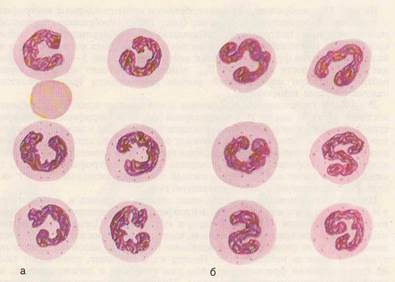 Granulele de granulocite (mieloide)