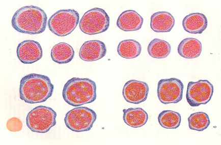 Granulele de granulocite (mieloide)