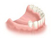 Implantarea dinților în Austria, tratament în Austria, stomatologie în Austria