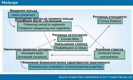 Інтрастромальний рогівкові кільця хвороби очей