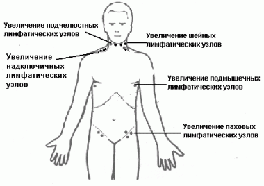 A sorvadást a csecsemőmirigy (thymus)