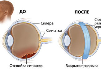 Cum se trateaza prostatita