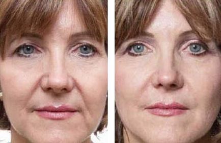 Hogyan anti-aging arc home video