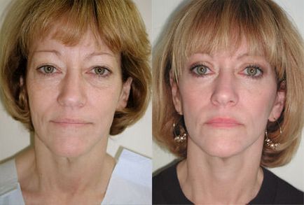 Hogyan anti-aging arc home video