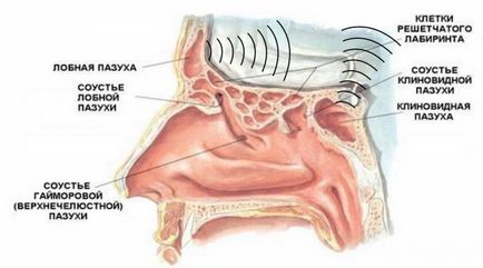 Cyst în sinus maxilar - fotografii, raze X, kt-imagini