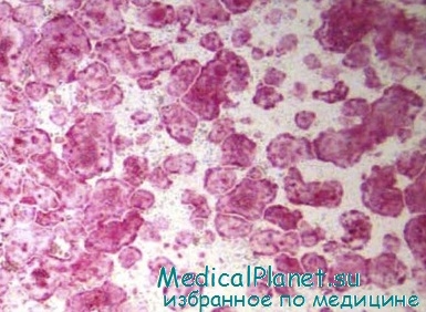 Structura matricei osoase, histologie