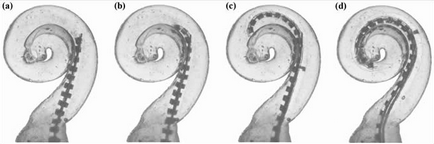 Кохлеарний імплант cochlear особливості та технології