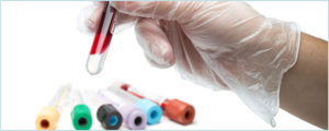 Testarea cantitativă pentru tuberculoză în vitro ceea ce este și modul în care este efectuată