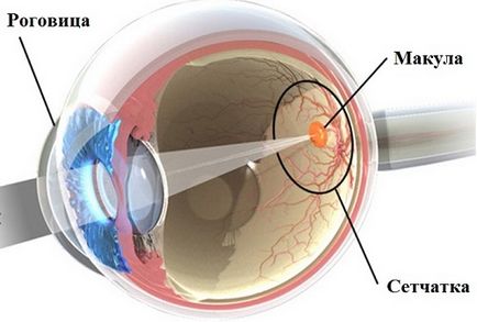 Tratamentul distrofiei retinale conservator și chirurgical
