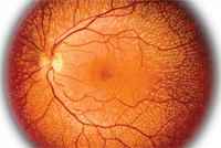 Tratamentul retinei