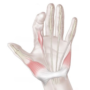 Betegségek kezelési az ízületek a kéz és a láb - konstriktív ínszalagok, kéztőcsatorna szindróma,