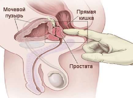 localizare prostata