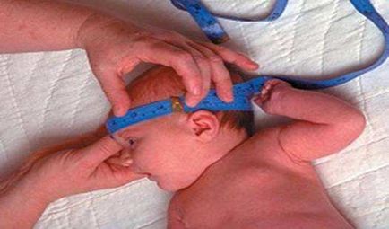 Circumferinta capului si a toracelui copilului este normala, masa se refera la bebelusii de la a la i