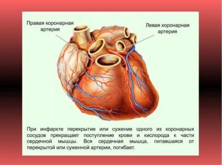 сърдечен арест