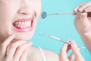 Перфорація зуба - лікування при перфорації зуба