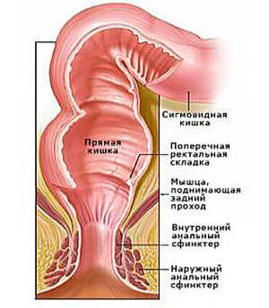 Пошкоджена пряма кишка причини, ознаки, лікування - жіночий сайт