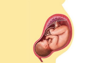 Poziția corectă și incorectă a fătului în uter este modul de determinare și ce trebuie făcut în continuare