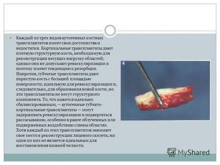 Prezentarea pe această temă a fost efectuată de studenții grupului 24 din anul 5 al facultății stomatologice din Kirichuk r