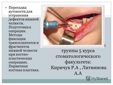 Prezentarea pe această temă a fost efectuată de studenții grupului 24 din anul 5 al facultății stomatologice din Kirichuk r