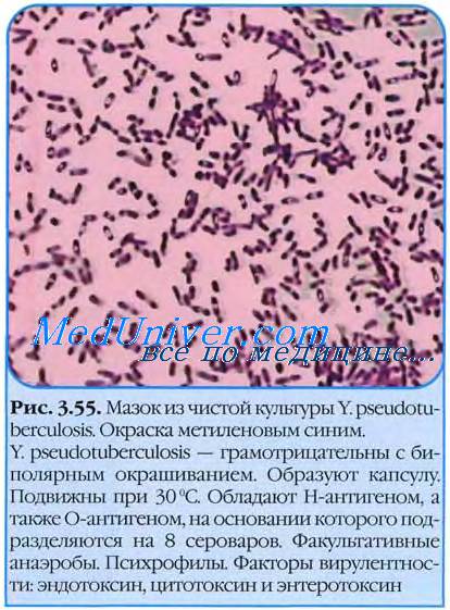 Pseudotuberculoza - istorie, geografie, agenți patogeni