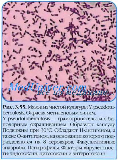 Pseudotuberculoza - istorie, geografie, agenți patogeni (agenți patogeni) Pseudotuberculoza - istorie, geografie, agenți patogeni