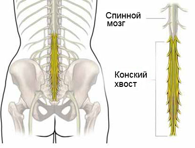 Радикуліт шийний, грудний, попереково-крижовий симптоми і лікування